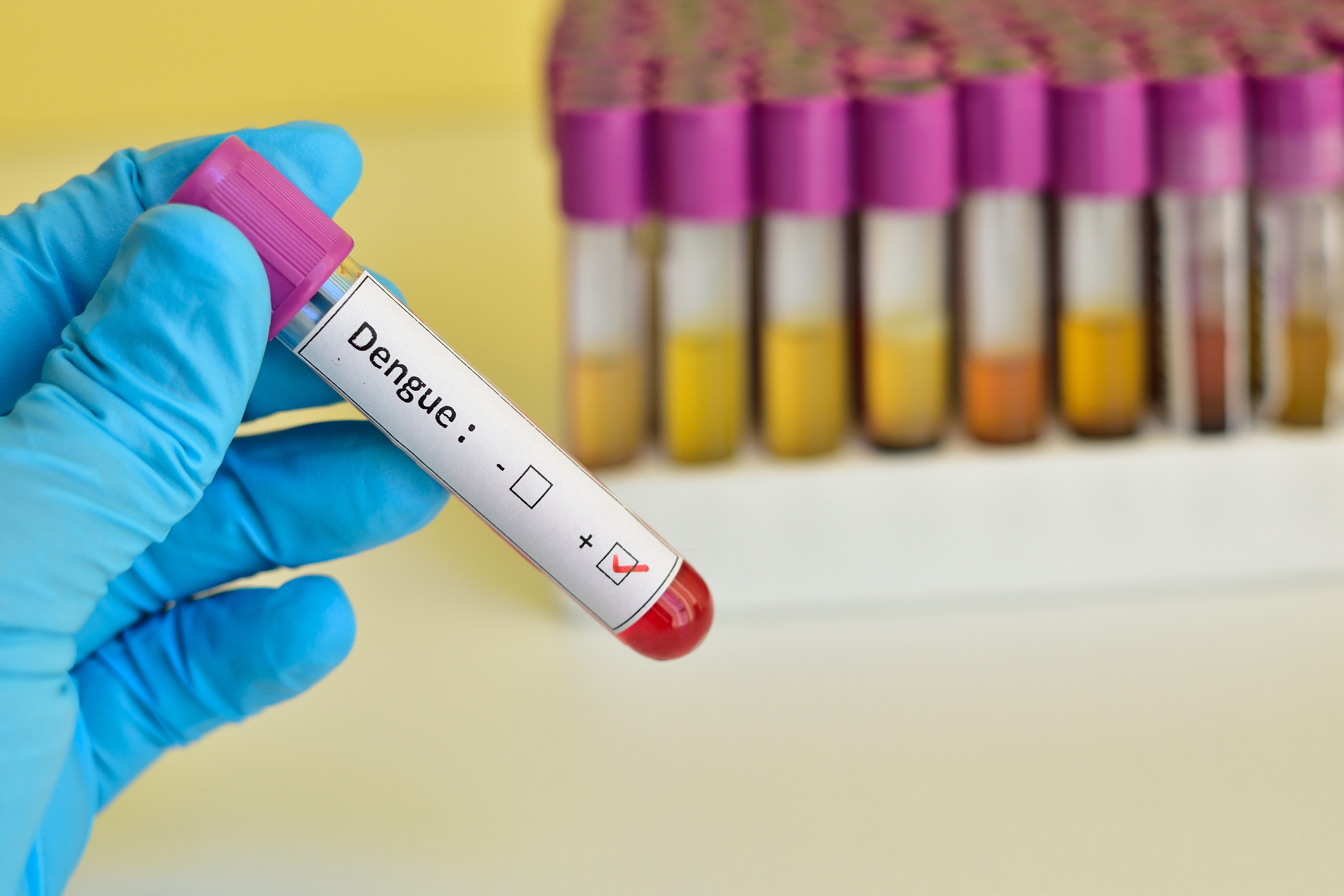 Dengue Lab Test